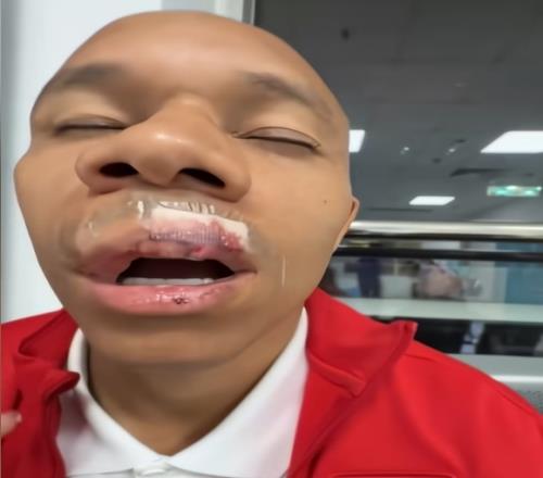 遭姜至鵬肘擊！蓉城外援重傷：嘴唇縫15針+牙齒脫位，下輪或缺戰(zhàn)