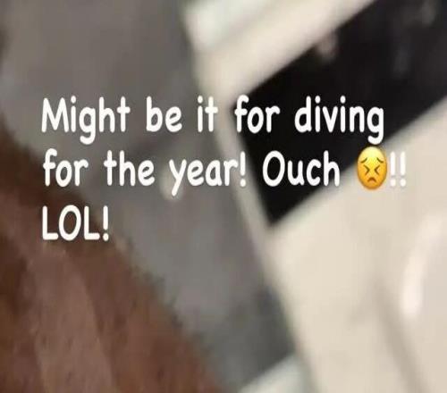 滲人！詹姆斯曬血肉傷口！真的太拼了.....