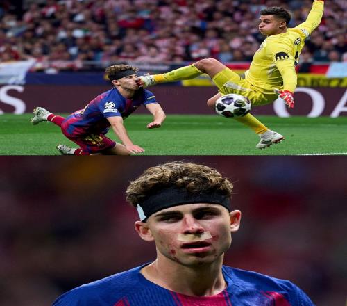 慎入，費(fèi)爾明被穆索用鞋釘?shù)胖忻娌浚r血直流