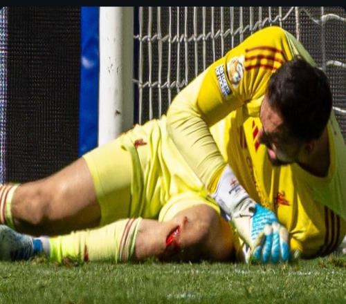 慎入！默西塞德德比中，馬馬爾達什維利腿部被割開一個大傷口