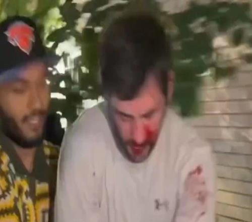 流氓行為！昨日一馬刺球迷被圍毆到滿臉是血，被要求脫球衣才能走