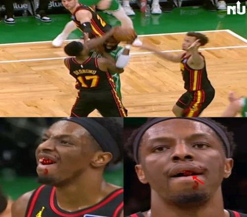 一肘打掉奧孔古牙齒，杰倫布朗：我絕對不是故意的