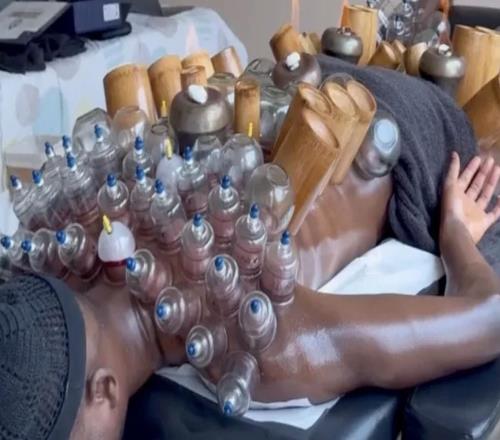 挺管用，吉拉西接受拔罐治療后在對(duì)陣美因茨時(shí)梅開(kāi)二度