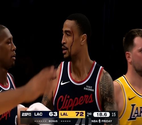 80+15+24!湖人三巨頭爆發,倫納德31分&傷退,新援轟26分難救主