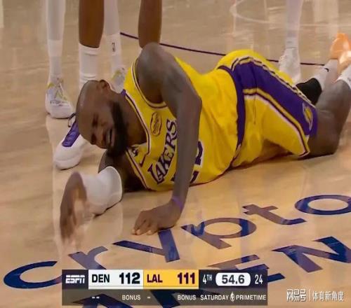 臥槽！詹姆斯曬傷口！直呼：疼死我了...