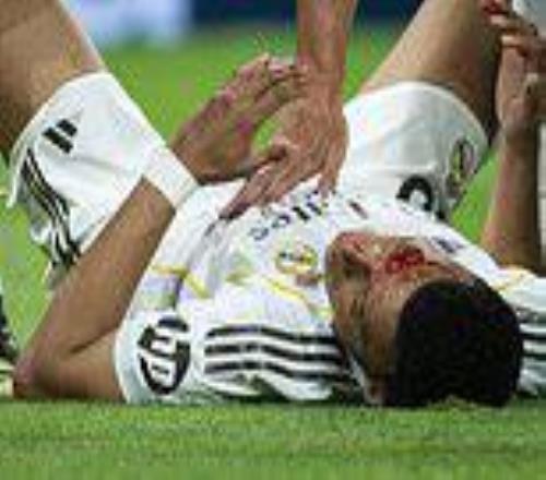 姆巴佩血染賽場VAR裝死，皇馬主帥：這球在月球都是點球