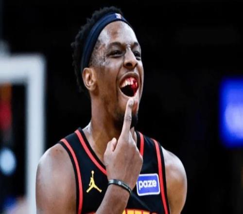 被打掉兩顆牙！老鷹官宣奧孔古成功手術(shù)缺席對(duì)陣火箭步行者兩場(chǎng)