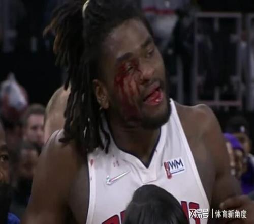 爆，無限期禁賽，血濺三尺+替補席爆燃，果真是血抗老詹的人