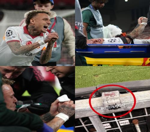 諾阿朗重傷手指醫生稱大拇指保得住的希望_英超直播