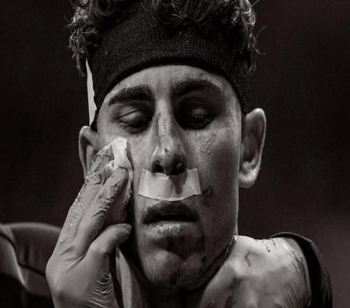 費爾明社媒曬臉部受傷照：我們付出了一切，我們會再回來的