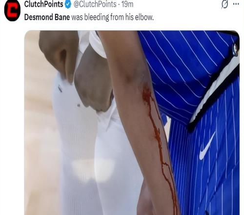 贝恩鲜血长流！制胜一击引莫兰特欢呼两战12三分魔术7换1真赢了