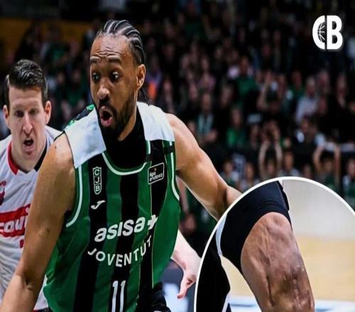 好可怕的膝盖！两次ACL撕裂，他还在打球！！！