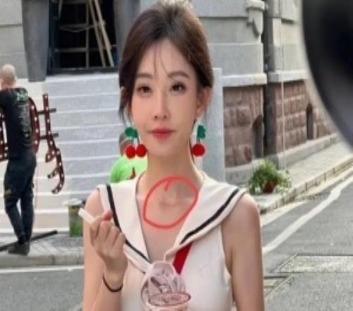 冯提莫公开甲状腺手术疤痕称其为“老天赐予的美丽微笑线”