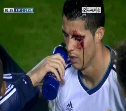 我无心肘击C罗却被媒体差点送进监狱的故事_西甲直播