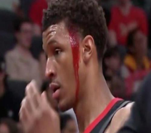 头打破了还要出战！火箭险胜鹈鹕，杜兰特完成绝杀