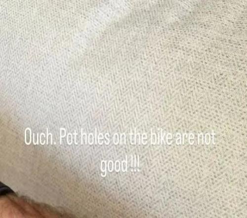 希勒骑车时因路面坑洞摔伤，手部和腿部有多处擦伤
